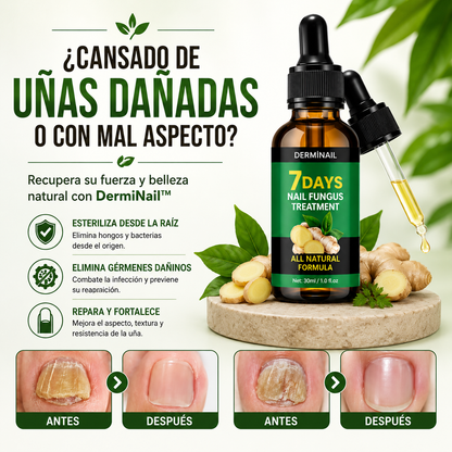 🦶 Derminail - TRATAMIENTO ANTI HONGOS 7 DÍAS 100% NATURAL