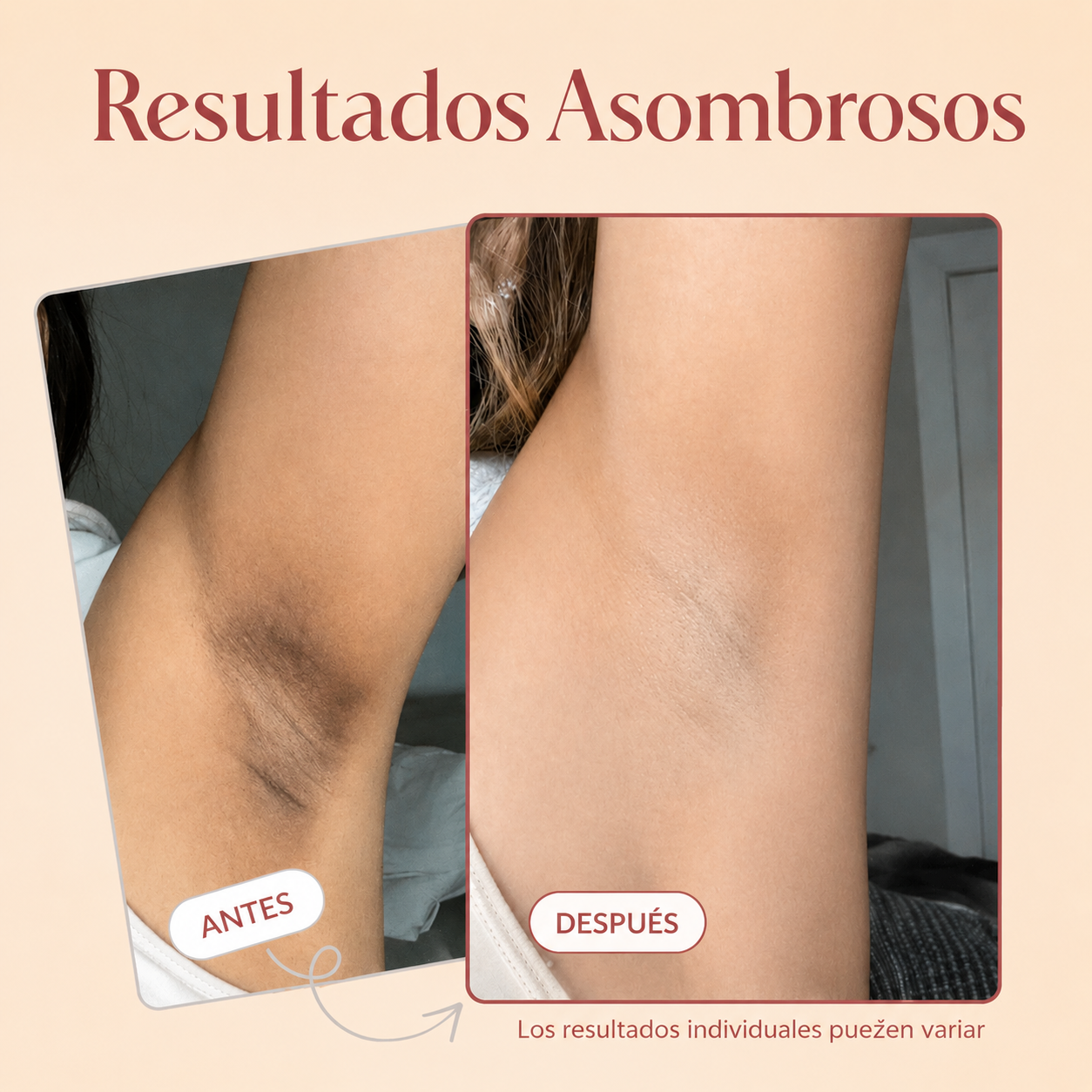 🧴 Peel Shot Exfoliante Corporal con Ácido kójico + Cúrcuma ⏳