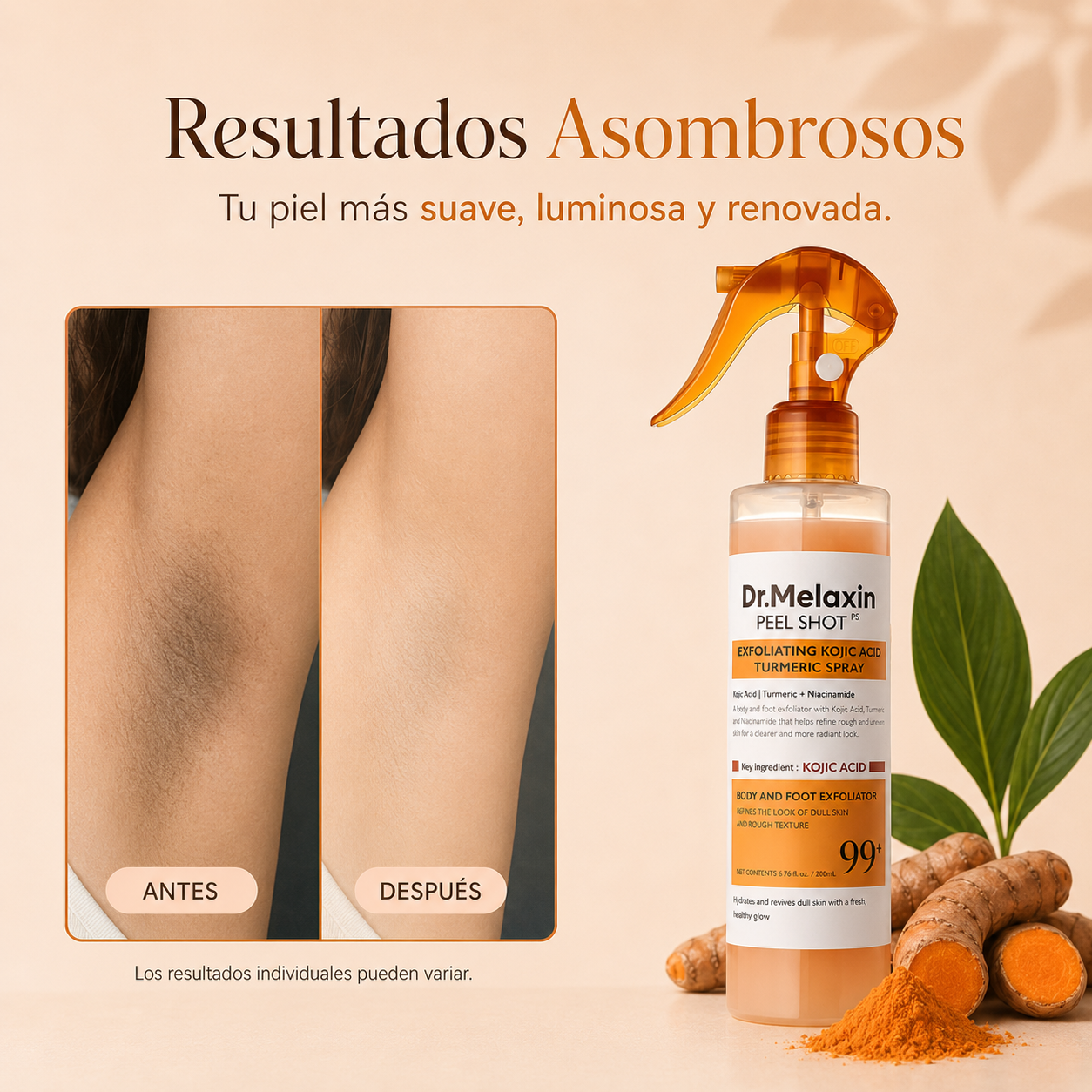 🧴 Peel Shot Exfoliante Corporal con Ácido kójico + Cúrcuma ⏳